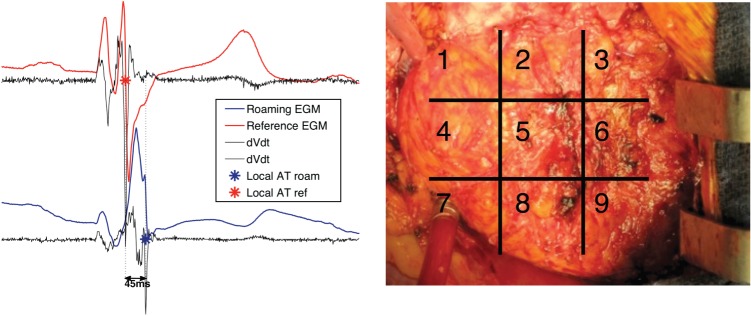 Figure 1