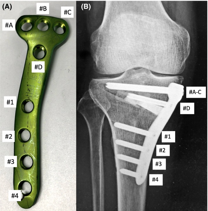 Figure 2