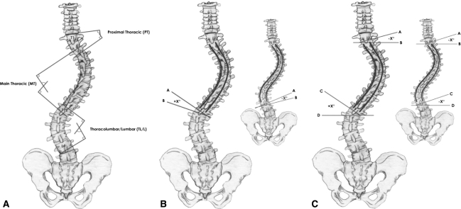 Fig. 4A–C