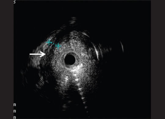 Figure 17