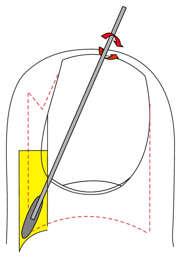 Figure 14