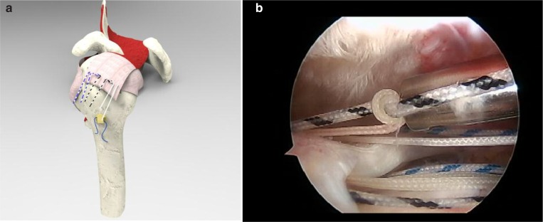 Figure 4 a, b.