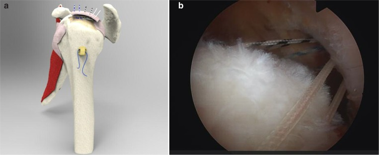 Figure 3 a, b.