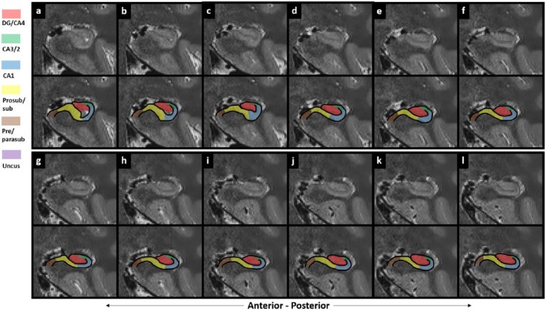 Figure 21