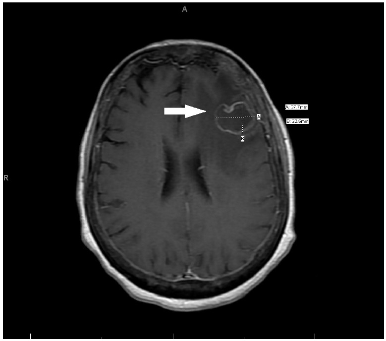 Figure 1.