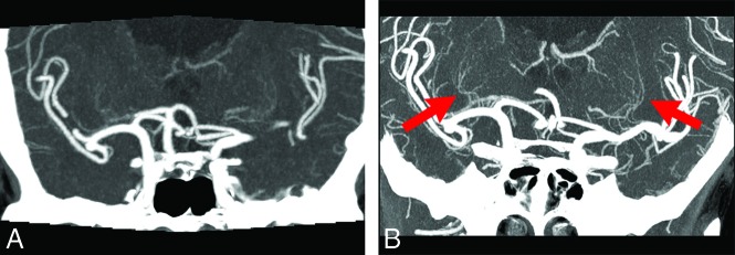 FIG 3.