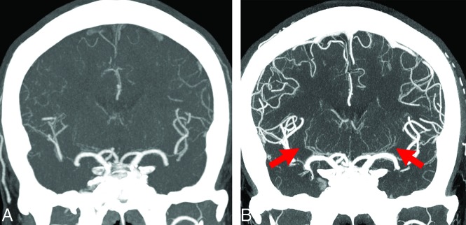 FIG 2.