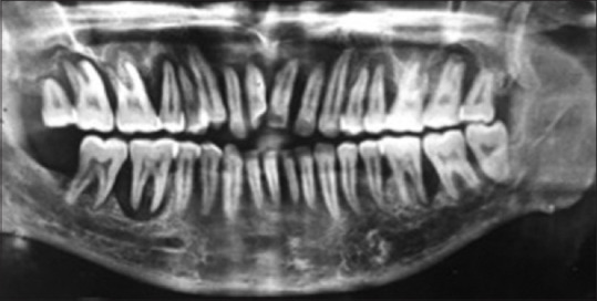 An Interdisciplinary Approach To The Management Of A Babe Patient With Generalized