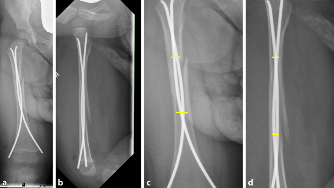 graphic file with name 104_2021_1437_Fig1_HTML.jpg