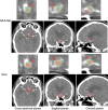 Fig. 10