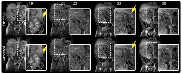 FIG. 7