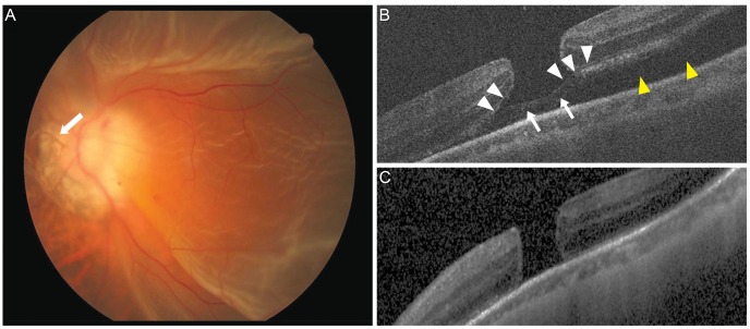 Fig. 2