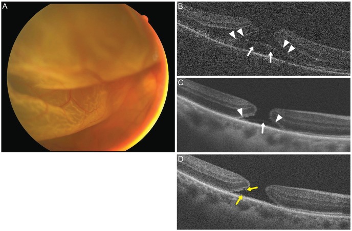 Fig. 3