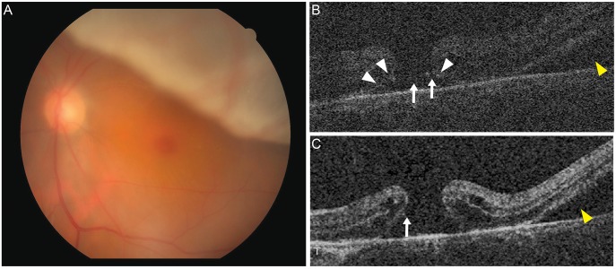 Fig. 4