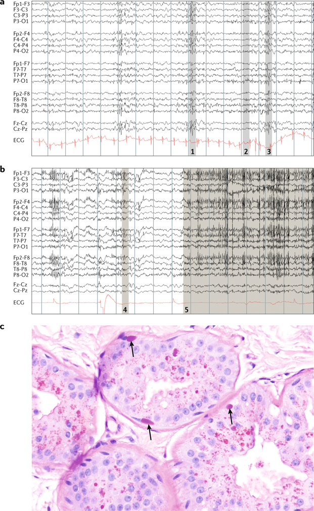 Fig. 4 |