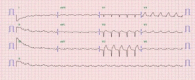Figure 3B