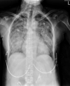 Figure 2B
