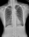 Figure 2A