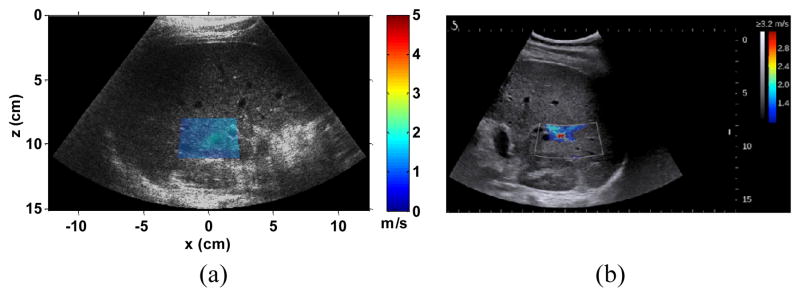 Fig. 15