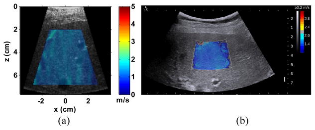 Fig. 12