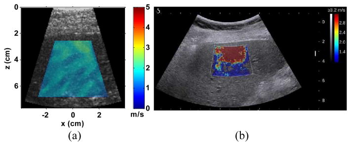 Fig. 13