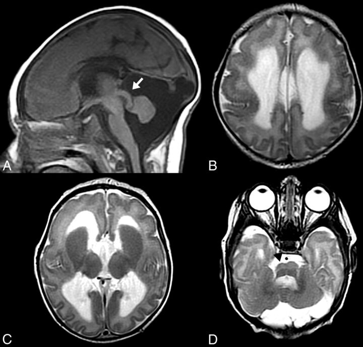 Fig 2.