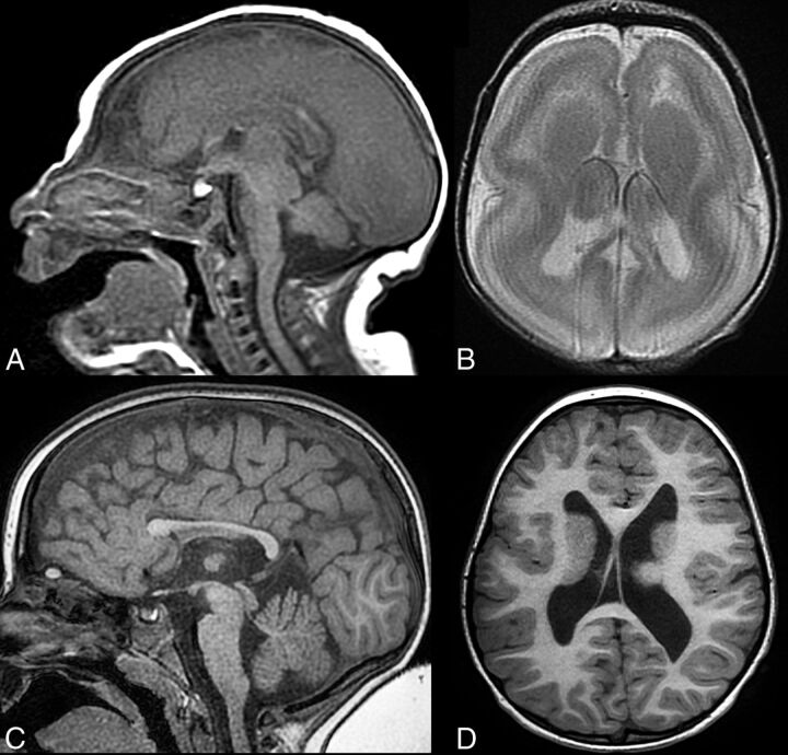 Fig 3.