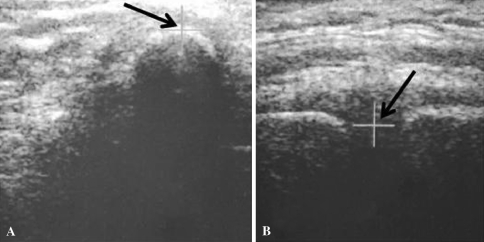 Fig. 2A–B