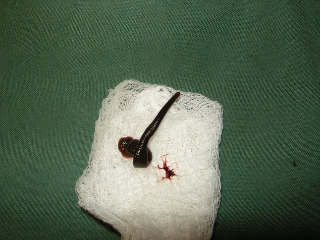 Fig. 1