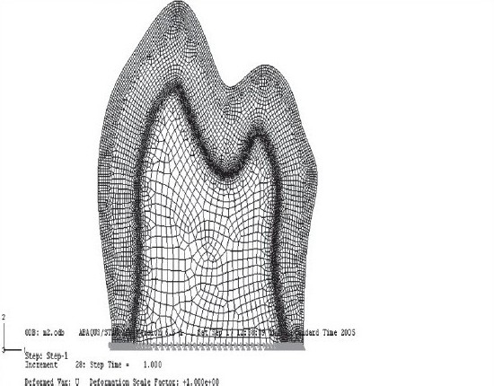 Figure 1b