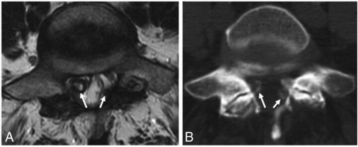 Fig 2.