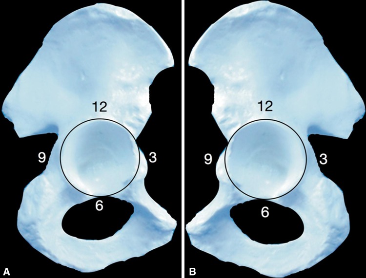 Fig. 1A–B