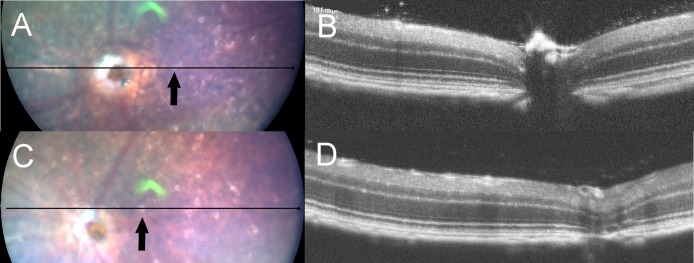 Fig 3