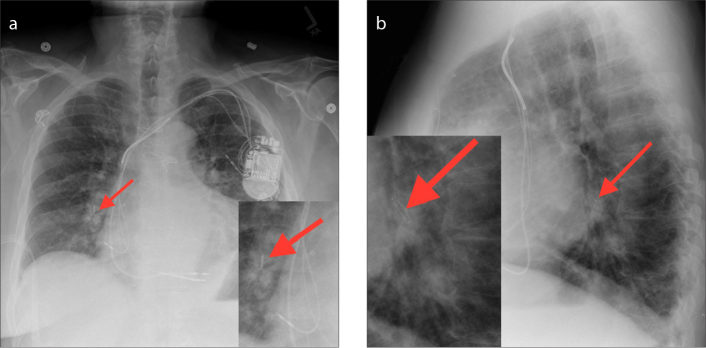 Figure 4 a, b