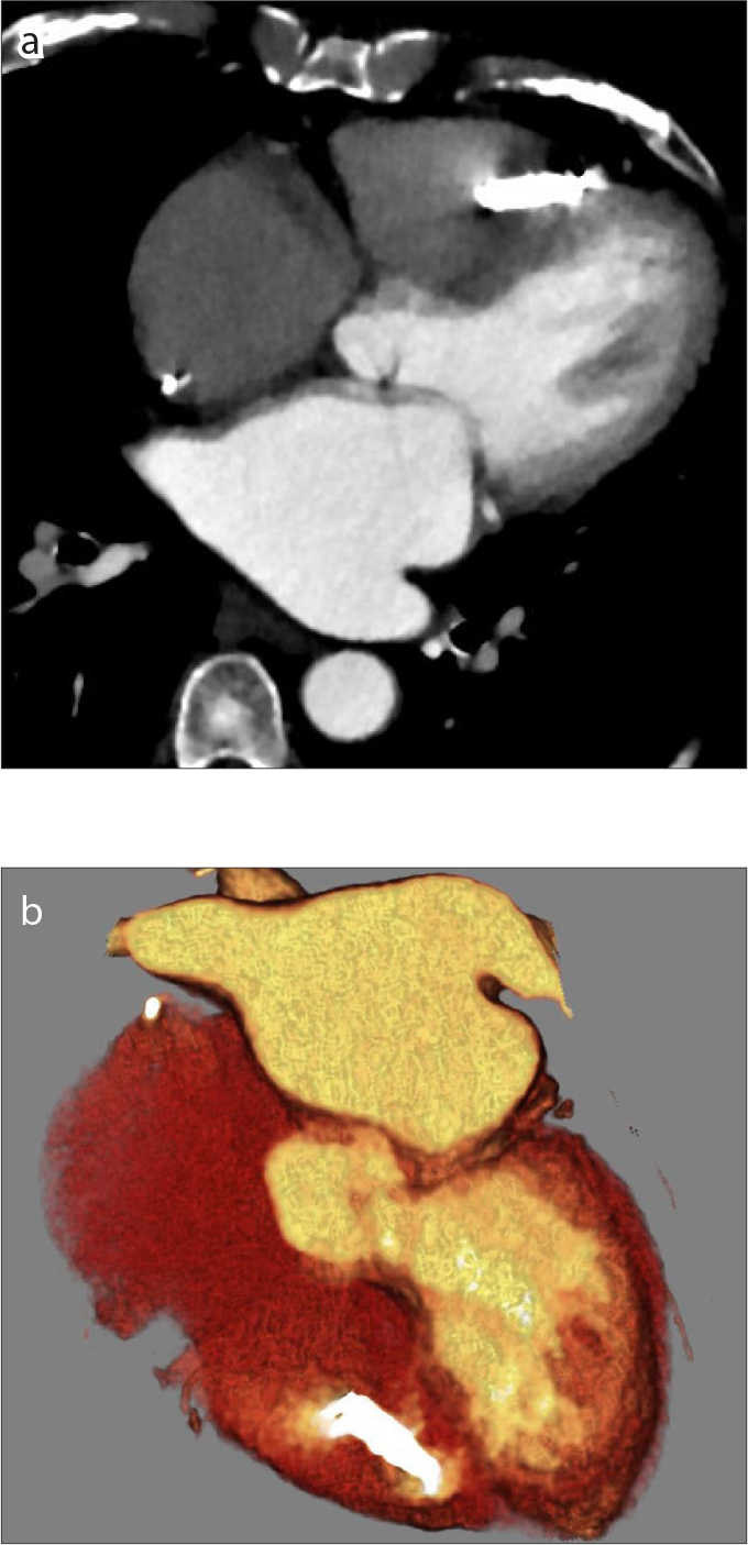 Figure 11 a, b