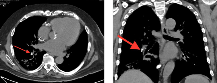 Figure 5 a, b