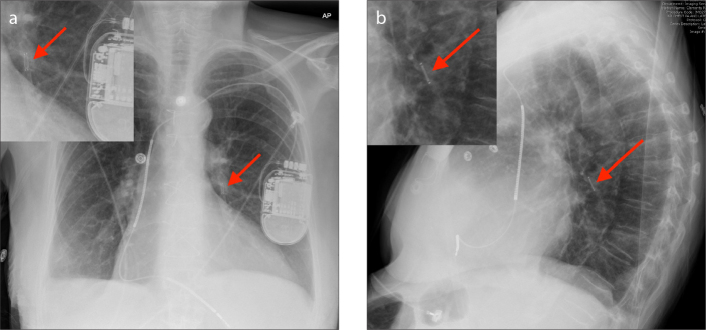 Figure 2 a, b