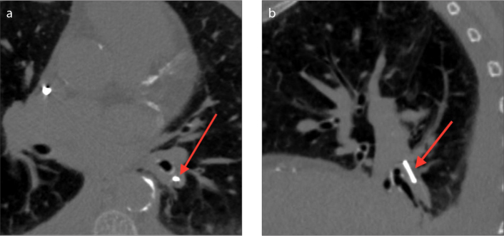 Figure 3 a, b