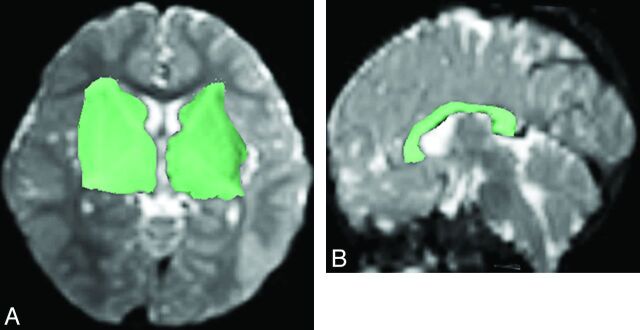 Fig 1.