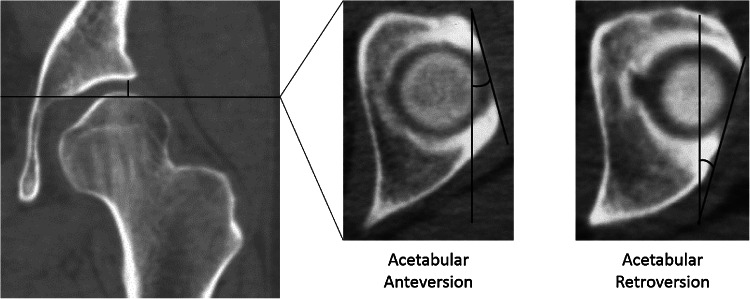 Fig. 2