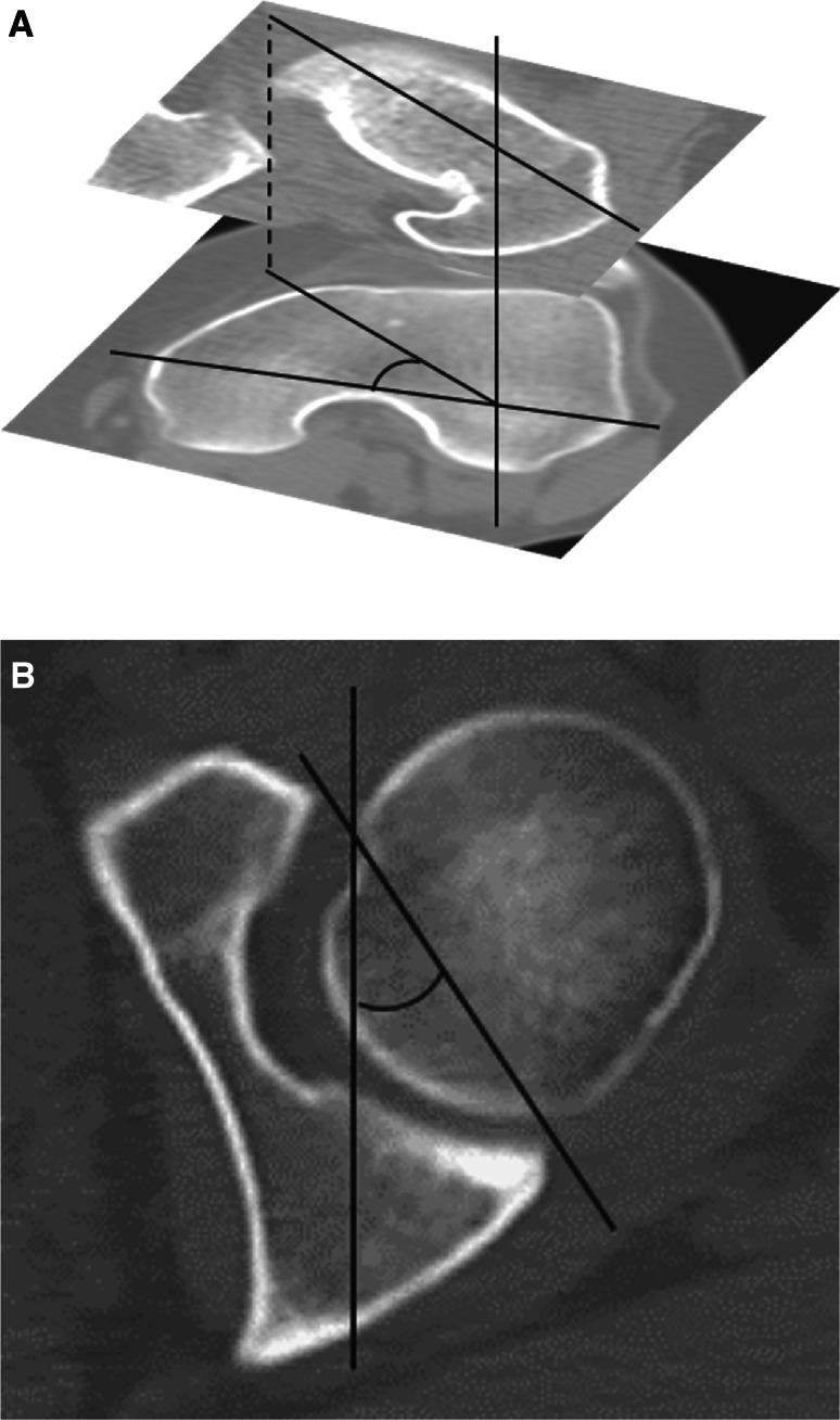 Fig. 1A–B