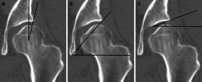 Fig. 3A–C