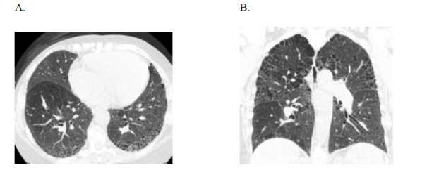 Fig. (3)