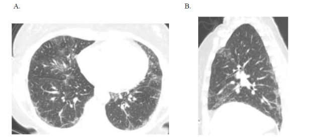 Fig. (1)