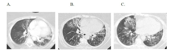 Fig. (4)