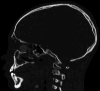 Fig 3: