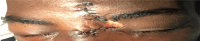 Fig 1: