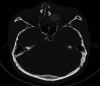 Fig 2: