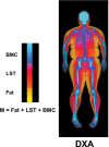 Body composition components measured with DXA. Body mass (M) is the sum of fat, LST, and BMC. BMC = bone mineral content, DXA = dual-energy x-ray absorptiometry, LST = lean soft tissue. (Adapted and reprinted, under a CC BY 3.0 license, from reference 23.)