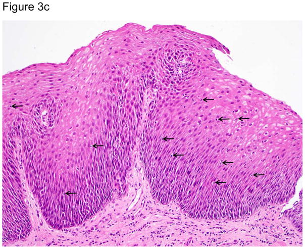 Figure 3a